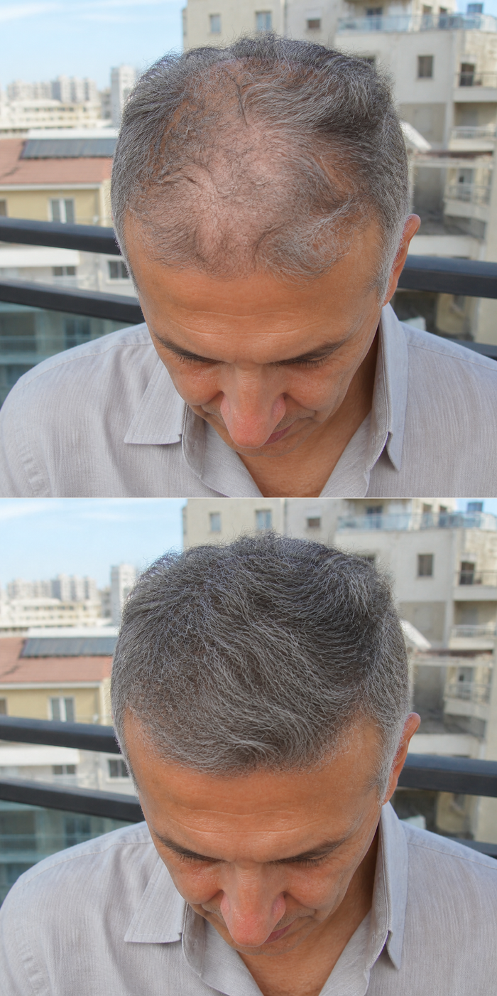 יוסי חזן